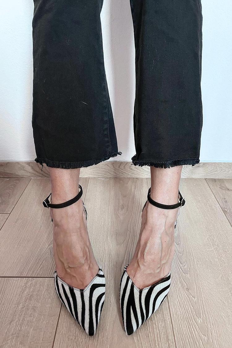 Zebra print pumps with ankle strap